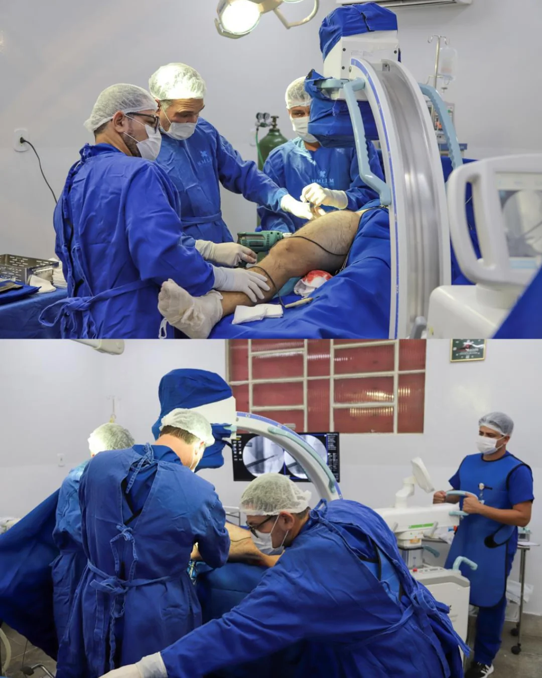 SÁBADO DE CIRURGIAS NO HOSPITAL MUNICIPAL DE LAPÃO