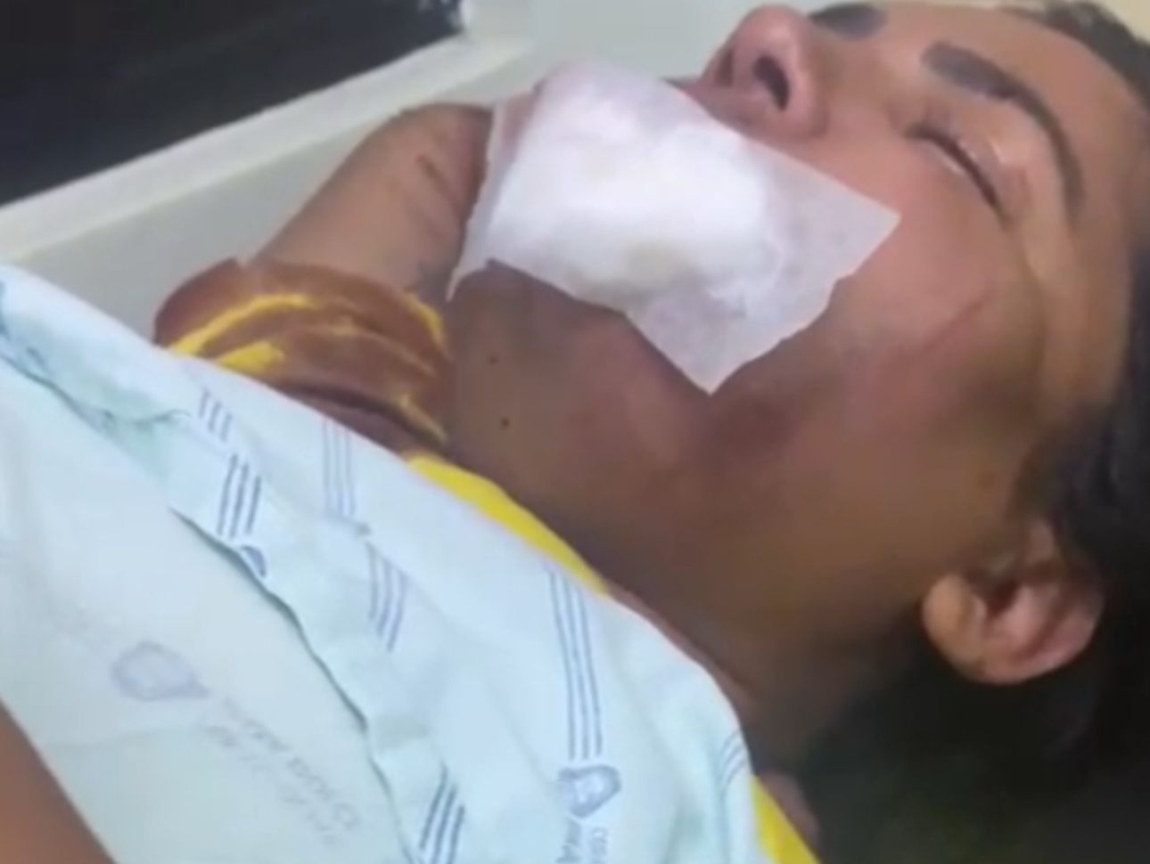 Violência Doméstica deverá passar por cirurgia para reconstrução do maxilar em Irecê