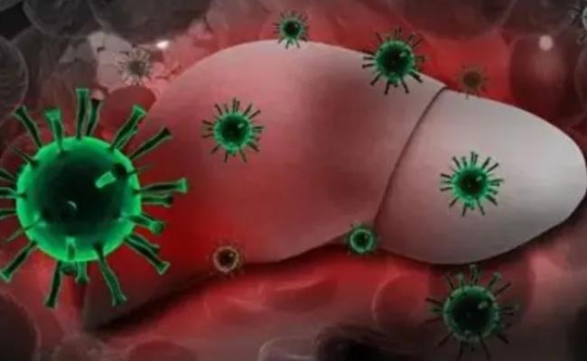 Saúde: Hepatite D passa a ser considerada cancerígena pela OMS
