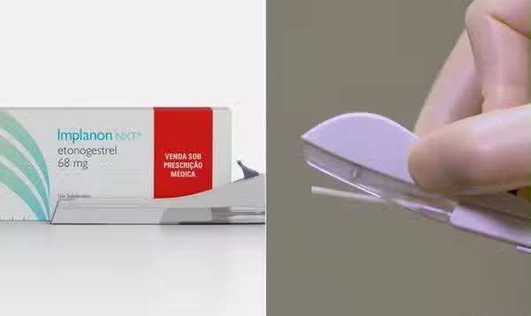 IMPLANON CHEGA ÀS COMUNIDADES E AMPLIA O ACESSO AO PLANEJAMENTO REPRODUTIVO EM IBIPEBA.