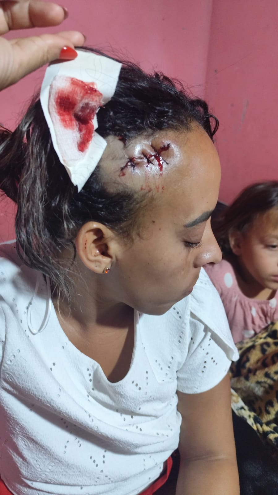 NOITE DE VIOLÊNCIA: MULHER É AGREDIDA E FICA FERIDA NA CABEÇA EM MORRO DO CHAPÉU.