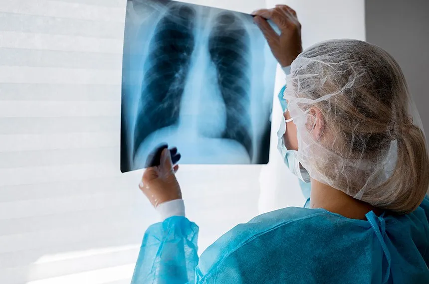 CÂNCER DE PULMÃO PODE TER ATÉ 95% DE CURA; CONHEÇA SINAIS DE ALERTA.