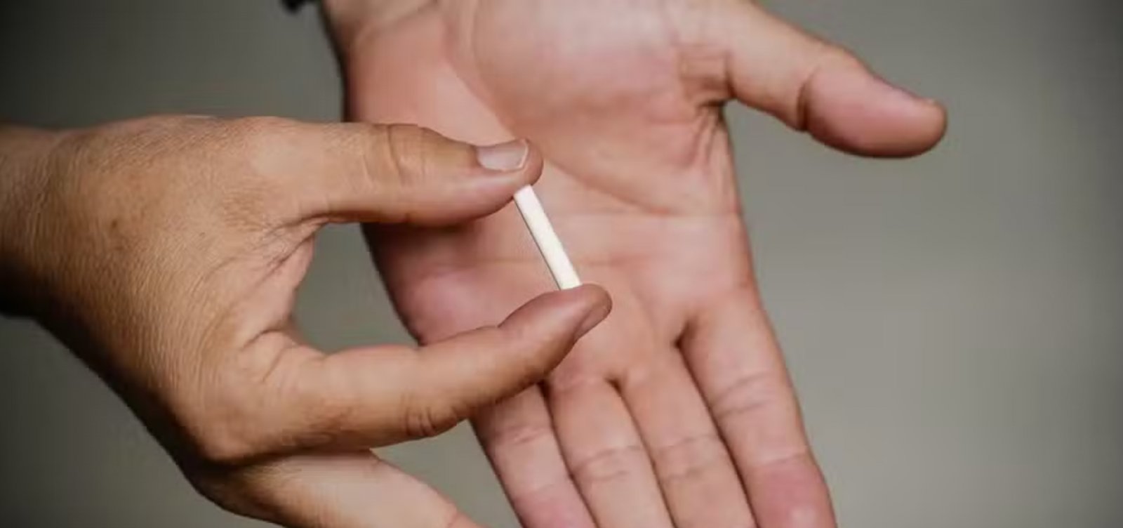 Entidades médicas nacionais e internacionais pedem para Anvisa a proibição total de implantes hormonais manipulados no Brasil